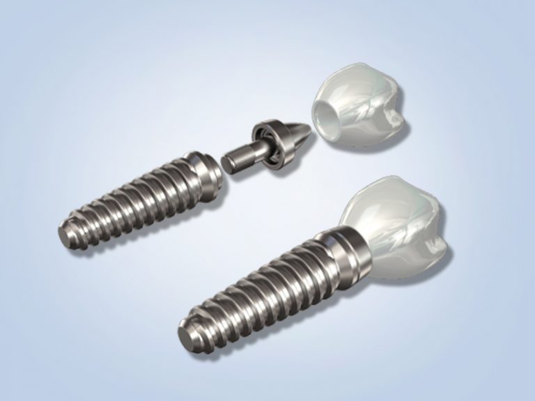 Are Titanium Implants the Best Solution? Dr. Terence Jackson